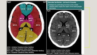 Radiological anatomy of brain.pptx