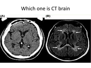 Which one is CT brain
 
