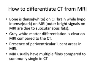 How to differentiate CT from MRI
• Bone is dense(white) on CT brain while hypo
intense(dark) on MRI(outer bright signals on
MRI are due to subcutaneous fats).
• Grey-white matter differentiation is clear on
MRI compared to the CT.
• Presence of periventricular lucent areas in
MRI.
• MRI usually have multiple films compared to
commonly single in CT
 