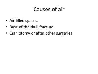 Causes of air
• Air filled spaces.
• Base of the skull fracture.
• Craniotomy or after other surgeries
 