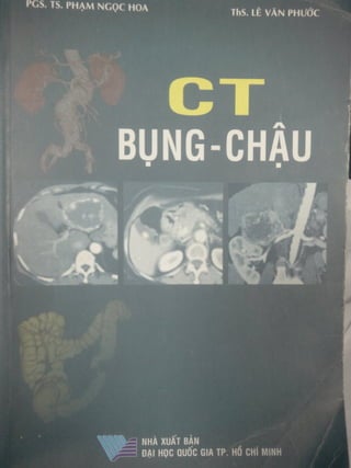 Ct bunq chau