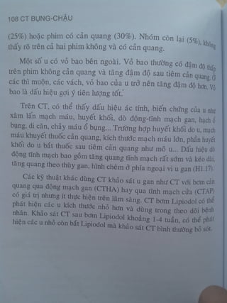 Ct bunq chau