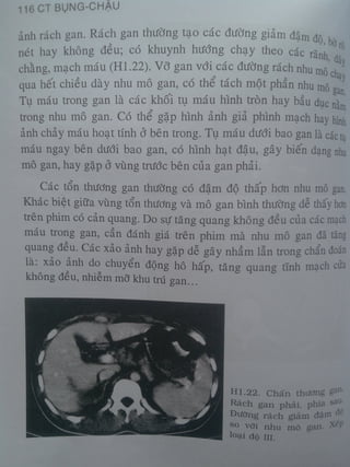 Ct bunq chau