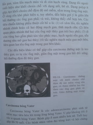 Ct bunq chau