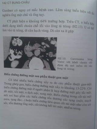 Ct bunq chau