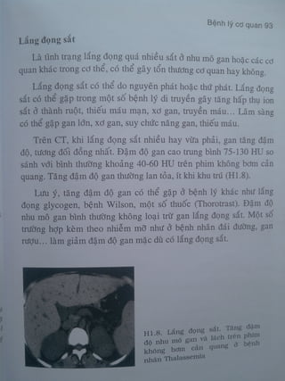 Ct bunq chau