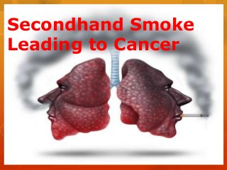 Secondhand Smoke
Leading to Cancer

 