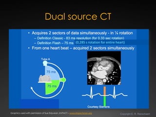 State-of-the-art Cardiac CT of the coronary arteries Slide 11