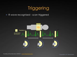 Triggering
     R wave recognised - scan triggered




                              Radiation on

                  (and...