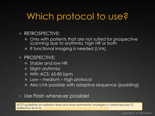 Which protocol to use?
  RETROSPECTIVE:
    Only with patients that are not suited for prospective
     scanning due to ...