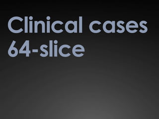 Clinical cases
64-slice
 