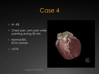 State-of-the-art Cardiac CT of the coronary arteries Slide 50