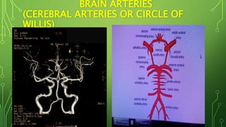 BRAIN ARTERIES
(CEREBRAL ARTERIES OR CIRCLE OF
WILLIS)
 