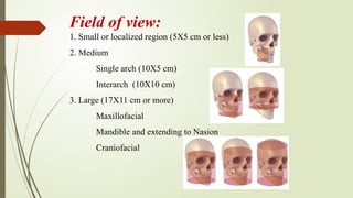 CT, Cone Beam Computed Tomography and MRI in dentistry.pptx