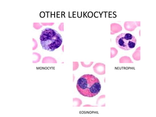 OTHER LEUKOCYTES
MONOCYTE NEUTROPHIL
EOSINOPHIL
 