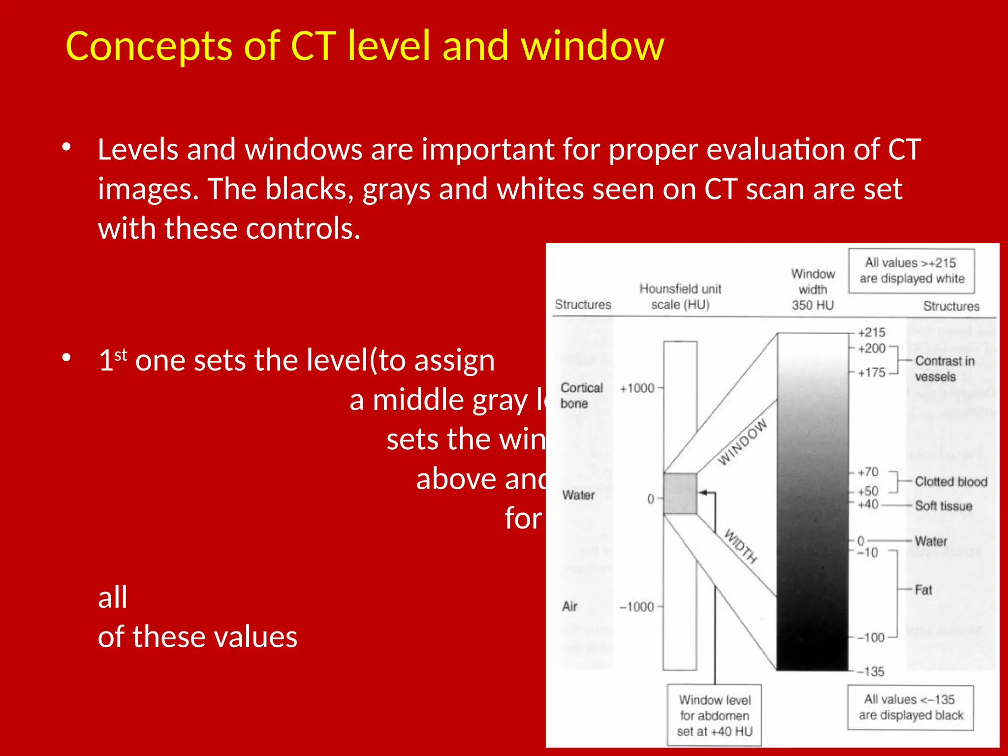 Basic interpretation of CT chest- identification of lobes and segments ...