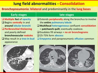 Ct chest fundamentals | PDF