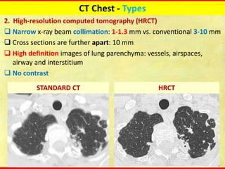 Tomography Types Computed tomography Chest Fundamentals update | PDF