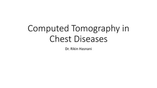 Computed Tomography in
Chest Diseases
Dr. Rikin Hasnani
 
