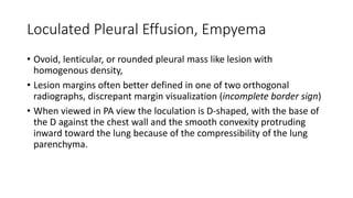 Loculated Pleural Effusion, Empyema
• Ovoid, lenticular, or rounded pleural mass like lesion with
homogenous density,
• Lesion margins often better defined in one of two orthogonal
radiographs, discrepant margin visualization (incomplete border sign)
• When viewed in PA view the loculation is D-shaped, with the base of
the D against the chest wall and the smooth convexity protruding
inward toward the lung because of the compressibility of the lung
parenchyma.
 