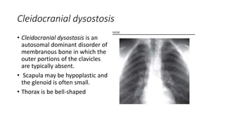 Cleidocranial dysostosis
• Cleidocranial dysostosis is an
autosomal dominant disorder of
membranous bone in which the
outer portions of the clavicles
are typically absent.
• Scapula may be hypoplastic and
the glenoid is often small.
• Thorax is be bell-shaped
 