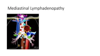 Mediastinal Lymphadenopathy
 