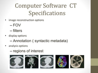 Computer Software CT
Specifications
• image reconstruction options
– FOV
– filters
• display options
– Annotation ( syntactic metadata)
• analysis options
– regions of interest
 