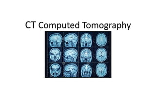 CT Computed Tomography
 