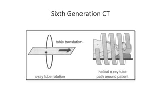 Sixth Generation CT
 