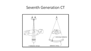 Seventh Generation CT
 
