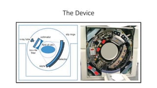 The Device
 