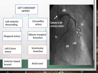 Marginal Ramus CT CORONARY ANATOMY of CT CARDIAC presentation.pptx