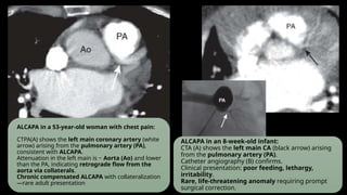Best Ppt on CT Coronary Angiography Pt1.pptx