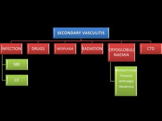 SECONDARY VASCULITIS
INFECTION
SBE
CF
DRUGS NEOPLASIA RADIATION CRYOGLOBULI
NAEMIA
Meltzer’s triad
-Purpura
-Arthralgia
-Weakness
CTD
 