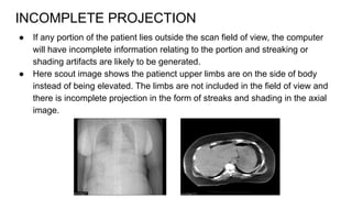 An overview of CT Detectors and Artefacts.pdf