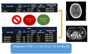 58.1/15.7
= 3.7
Abdomen CTDI VOL = 15.7 X 2 = 31.4 mGy (S)
58.1/31.4
= 1.85
 