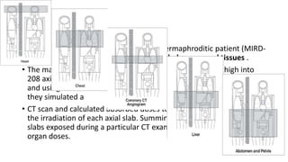 • Jones and Shrimpton used a simulated hermaphroditic patient (MIRD-
5 phantom) having mathematically modeled organs and tissues .
• The mathematic phantom was divided from head to mid thigh into
208 axial slabs of 5 mm thickness. Then, accounting for tube voltage
and using CT scanner–specific data for geometry and beam shaping,
they simulated a
• CT scan and calculated absorbed doses to all organs of the body for
the irradiation of each axial slab. Summing contributions from all
slabs exposed during a particular CT examination yielded the total
organ doses.
 