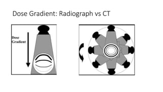 Dose Gradient: Radiograph vs CT
 