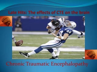 Late Hits: The effects of CTE on the brainChronic Traumatic Encephalopathy