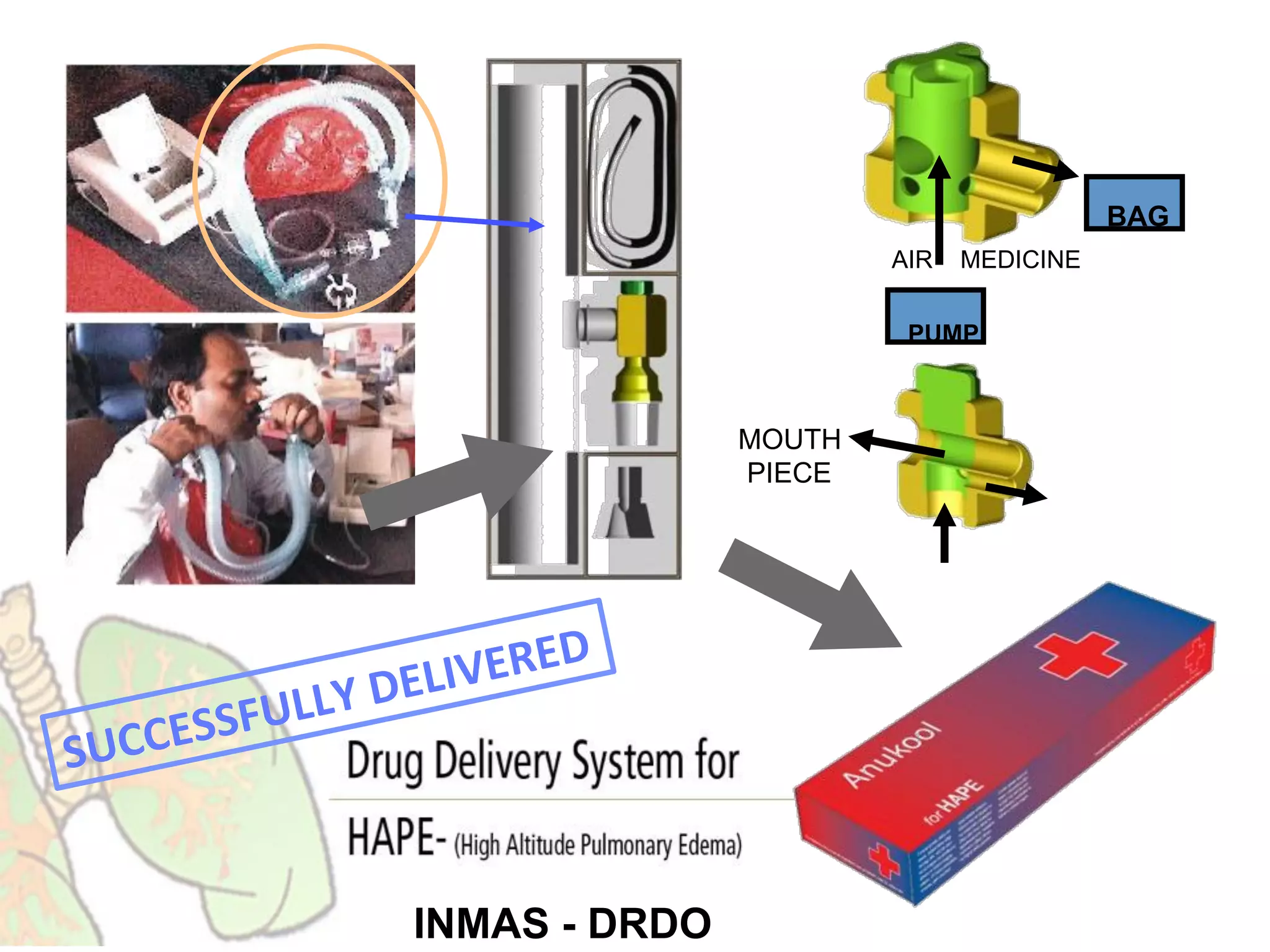 INMAS - DRDO
MOUTH
PIECE
PUMP
AIR MEDICINE
BAG
SUCCESSFULLY	
  DELIVERED	
  
 