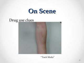 On SceneOn Scene
Drug use clues
“Track Marks”
18
 