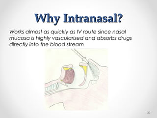 Why Intranasal?Why Intranasal?
Works almost as quickly as IV route since nasal
mucosa is highly vascularized and absorbs drugs
directly into the blood stream
30
 