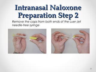Intranasal NaloxoneIntranasal Naloxone
Preparation Step 2Preparation Step 2
Remove the caps from both ends of the Luer-Jet
needle-free syringe
33
 