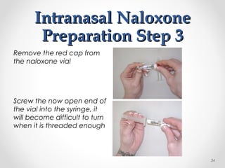 Intranasal NaloxoneIntranasal Naloxone
Preparation Step 3Preparation Step 3
Remove the red cap from
the naloxone vial
Screw the now open end of
the vial into the syringe, it
will become difficult to turn
when it is threaded enough
34
 