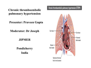 Chronic thromboembolic
pulmonary hypertension
Presenter: Praveen Gupta
Moderator: Dr Joseph
JIPMER
Pondicherry
India
 