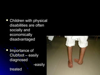 Congenital Talipes Equino Varus