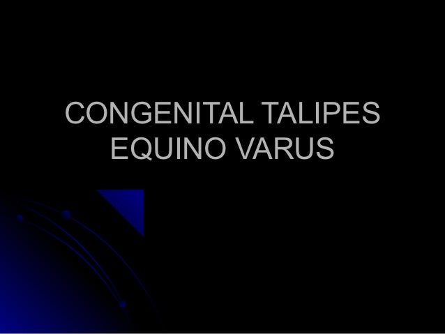 Congenital Talipes Equino Varus