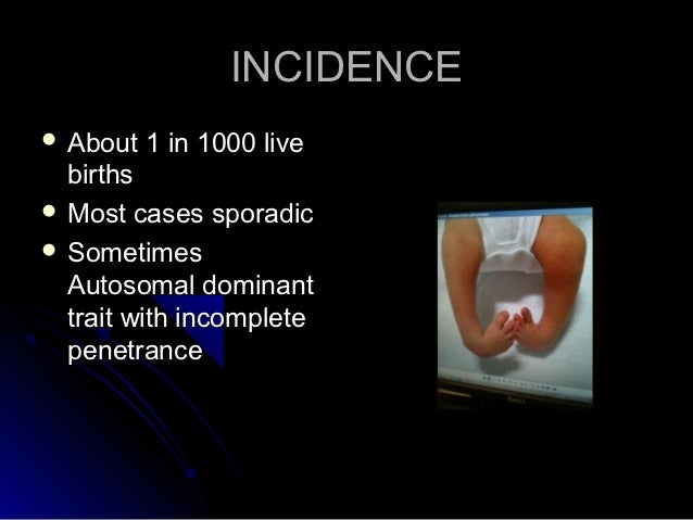 Congenital Talipes Equino Varus Congenital Talipes Equino Varus