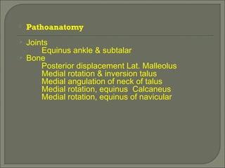 Pathoanatomy
 Joints
Equinus ankle & subtalar
 Bone
Posterior displacement Lat. Malleolus
Medial rotation & inversion talus
Medial angulation of neck of talus
Medial rotation, equinus Calcaneus
Medial rotation, equinus of navicular
 
