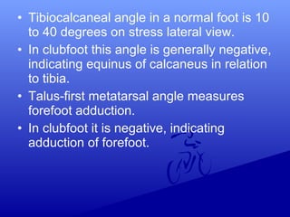 • Tibiocalcaneal angle in a normal foot is 10
to 40 degrees on stress lateral view.
• In clubfoot this angle is generally negative,
indicating equinus of calcaneus in relation
to tibia.
• Talus-first metatarsal angle measures
forefoot adduction.
• In clubfoot it is negative, indicating
adduction of forefoot.
 